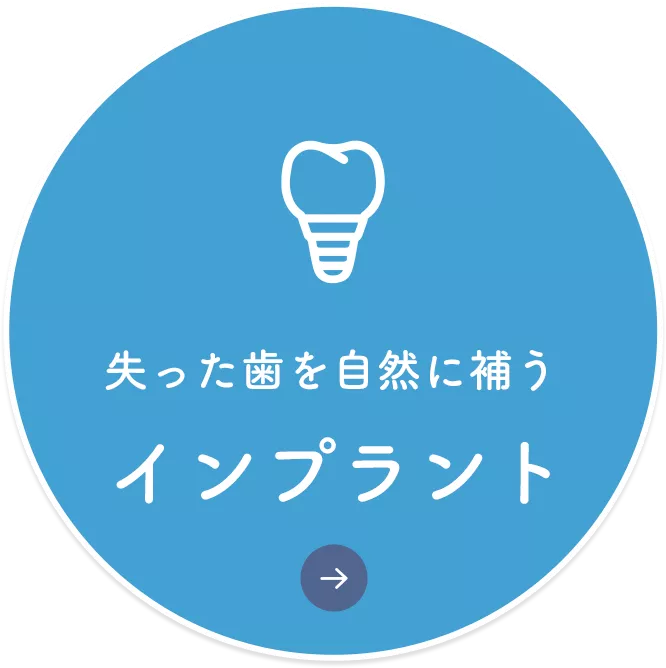 インプラント